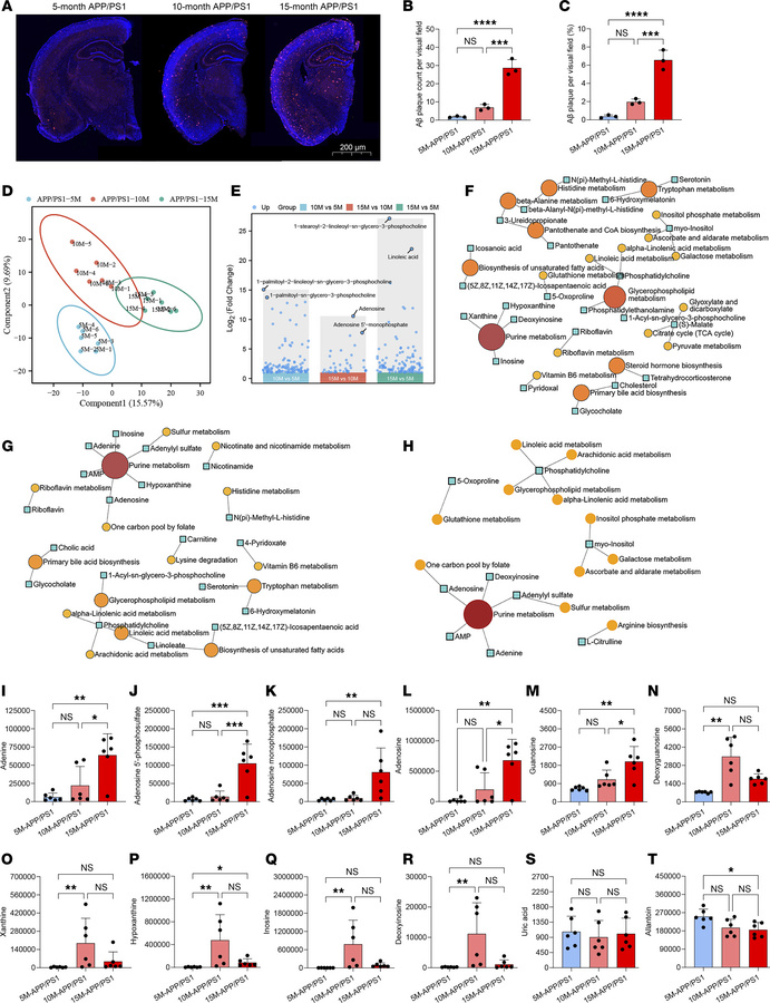Metabolic profile differences in serum of APP/PS1 mice at different ages...