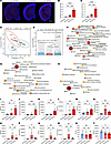 Metabolic profile differences in serum of APP/PS1 mice at different ages.