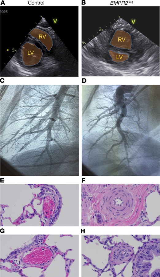 Pulmonary hypertension evaluation.
Echocardiography at 3 weeks of age, w...