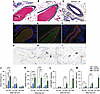 Histopathology of pulmonary arteries from lungs from BMPR2+/– lambs 5 and 6