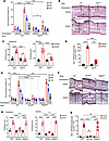 SP and the NK1R are necessary for the skin innate immunity triggered by top