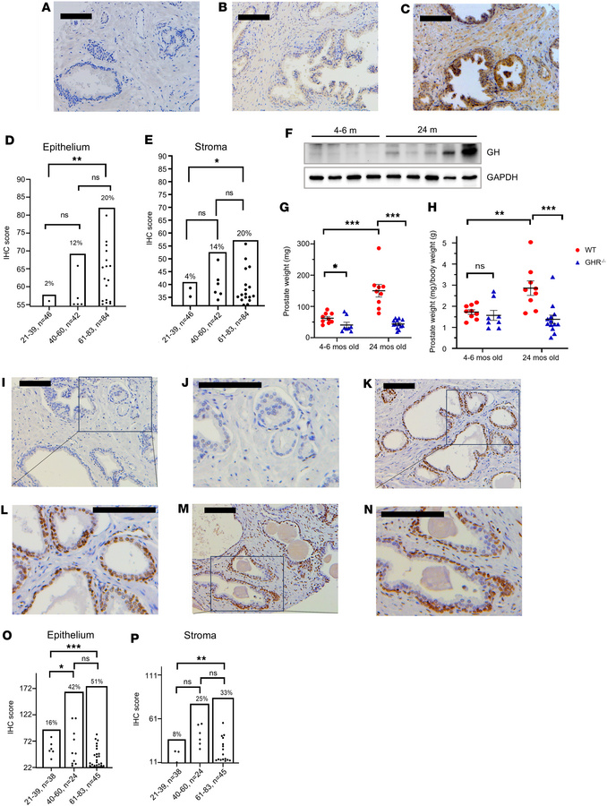 Prostate npGH and γH2AX expression increases with age.
(A–C) Representat...