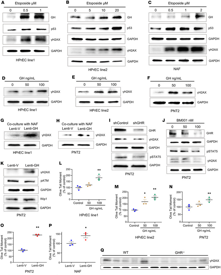Prostate cell DNA damage response triggers npGH expression, further enha...