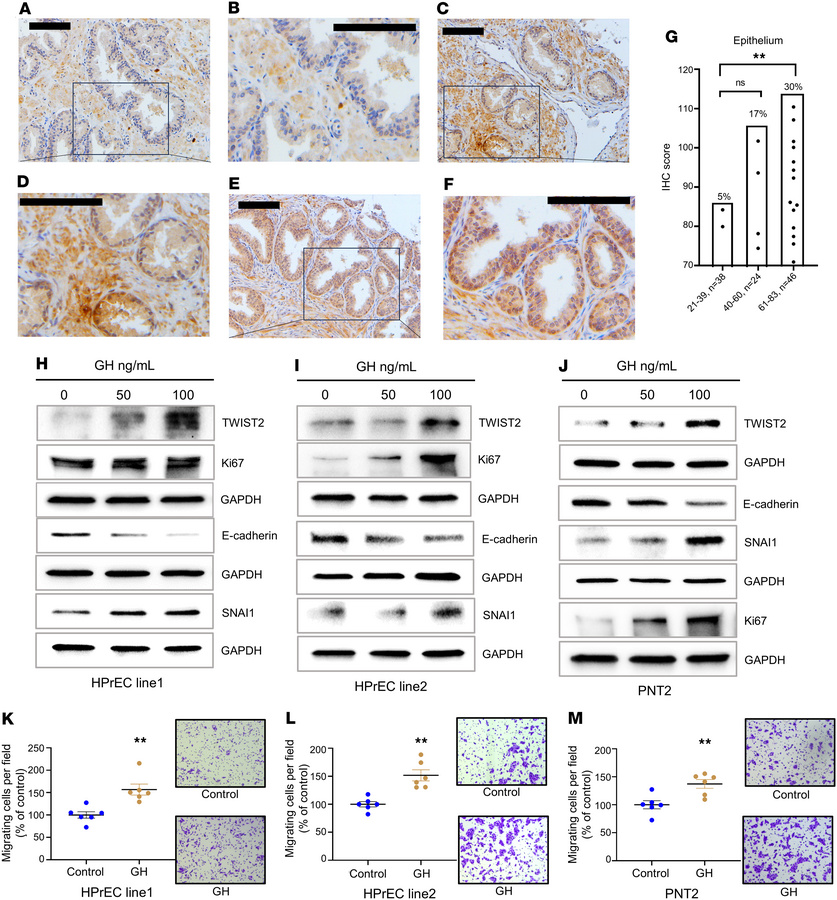 Age-associated stimulation of prostate EMT and proliferation are mediate...