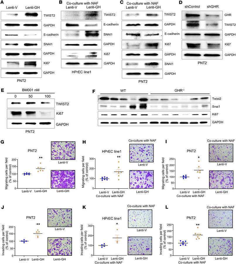 Autocrine/paracrine GH induces prostate EMT and proliferation.
(A–E) Wes...