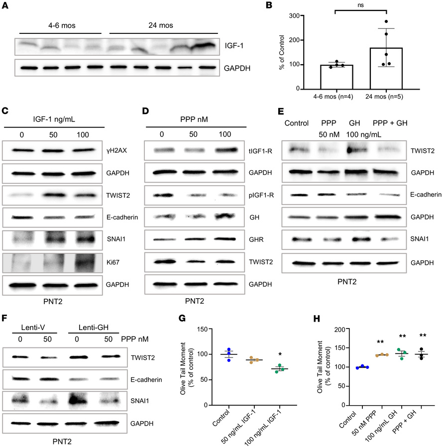 IGF-1 induces EMT and proliferation, but attenuates DNA damage.
(A and B...