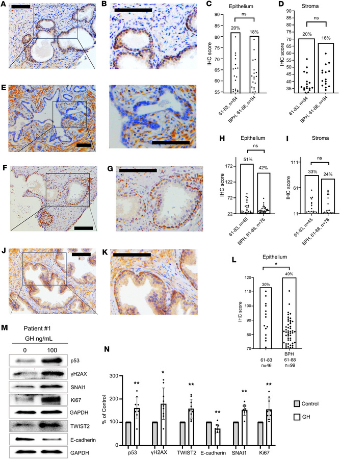 npGH, γH2AX, and TWIST1/2 expression is increased in aged normal human p...