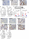 Prostate npGH and γH2AX expression increases with age.
