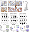 Age-associated stimulation of prostate EMT and proliferation are mediated b