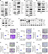 Autocrine/paracrine GH induces prostate EMT and proliferation.