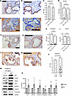 npGH, γH2AX, and TWIST1/2 expression is increased in aged normal human pros