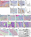 Endocrine/paracrine GH induces changes consistent with BPH.