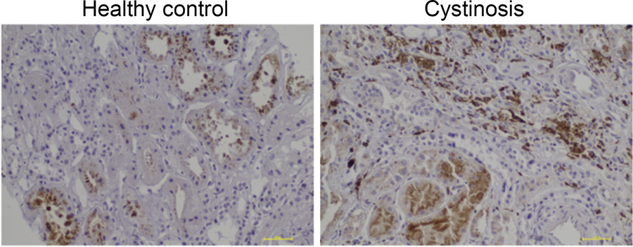 IHC staining of healthy control tissues shows no significant interstitia...