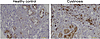 IHC staining of healthy control tissues shows no significant interstitial s