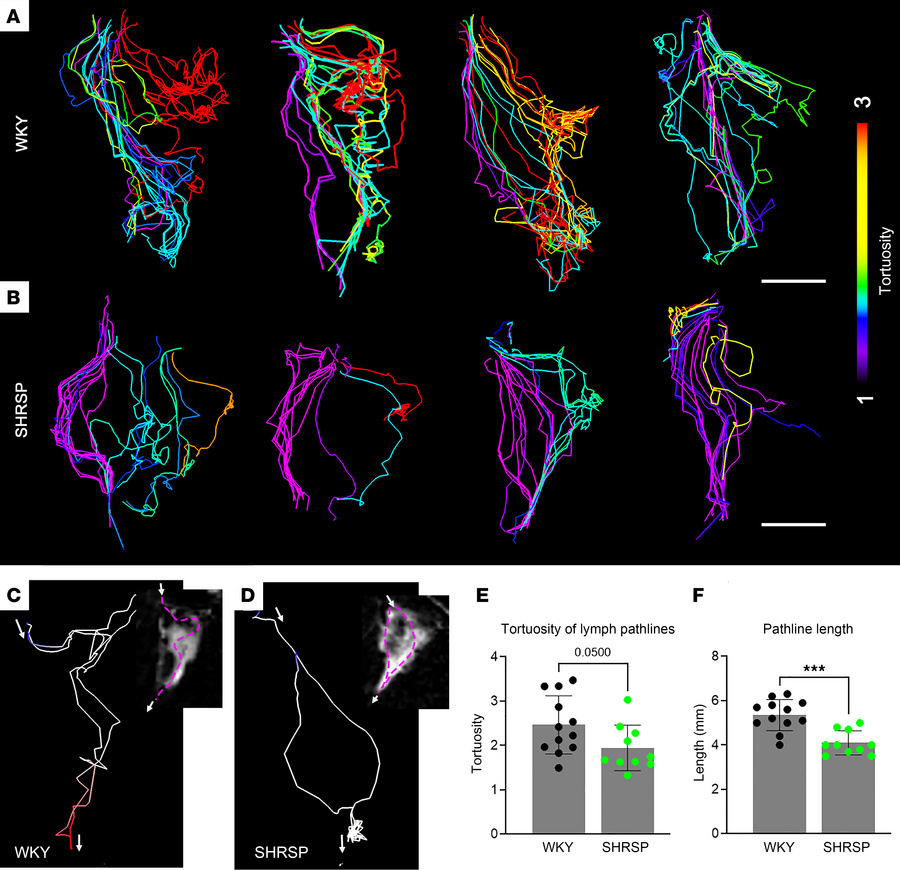 Tracer pathlines are more tortuous in the dcLNs of hypertensive rats.
(A...