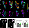 Tracer pathlines are more tortuous in the dcLNs of hypertensive rats.