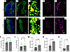 Histopathology of dcLNs from WKY and SHRSP rats.