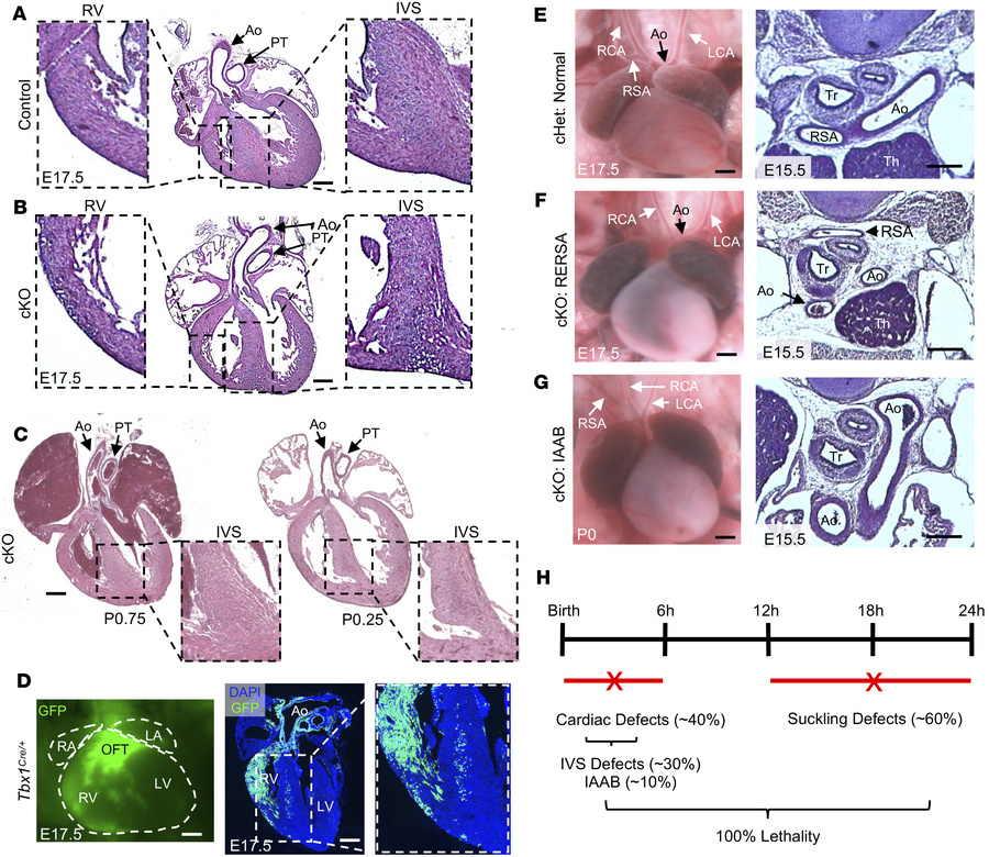 
Kmt2d-cKO embryos have cardiac and aortic arch defects.
(A) Control hea...