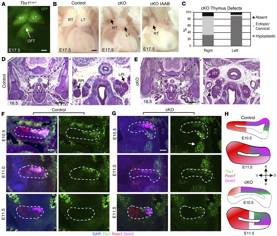 
Kmt2d-cKO embryos exhibit thymus and parathyroid gland defects and thir...
