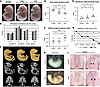 Inactivation of Kmt2d in the Tbx1 lineage leads to fully penetrant perinata