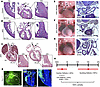 Kmt2d-cKO embryos have cardiac and aortic arch defects.