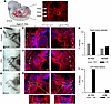 Kmt2d-cKO embryos have more severe fourth PAA defects than other genotypes.