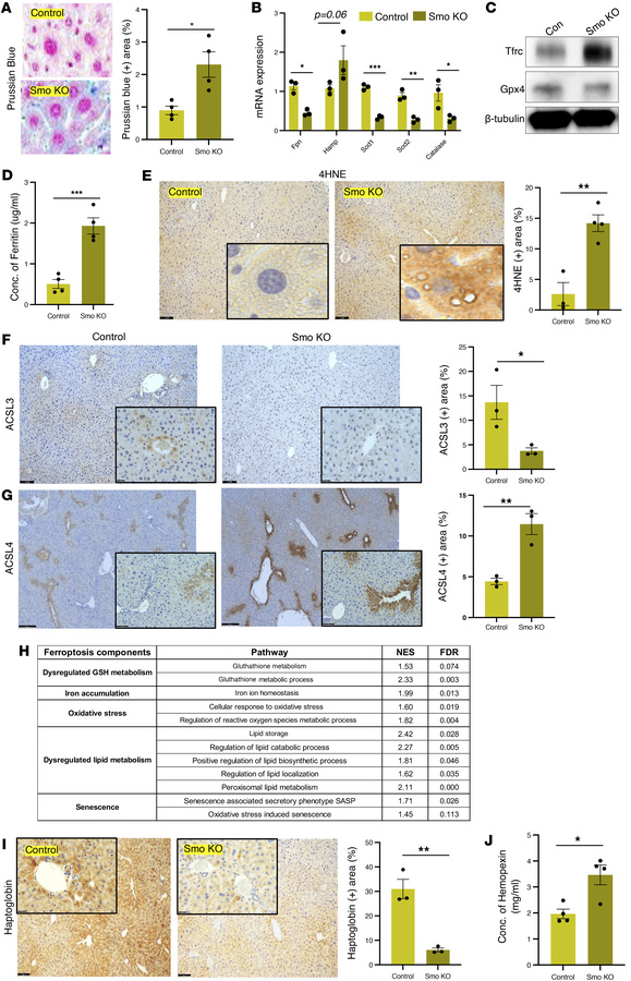 Hepatocyte-specific deletion of Smo induces hepatic iron accumulation an...