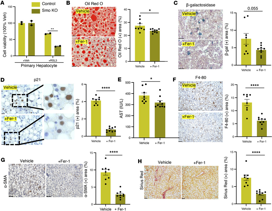 Ferrostatin-1 treatment alleviates hepatic ferroptotic stress and attenu...