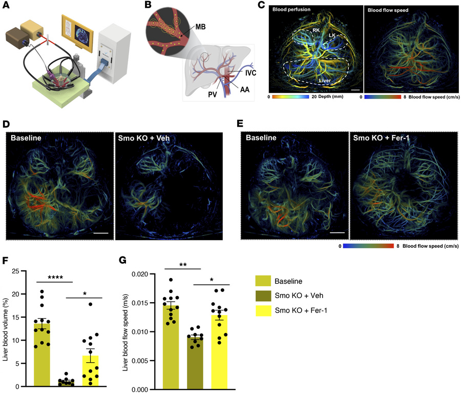 Ferrostatin-1 restores hepatic blood perfusion and reverses vascular dys...