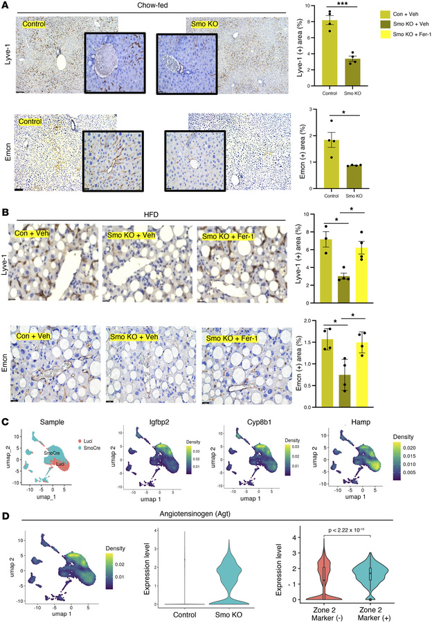 Ferrostatin-1 attenuates liver sinusoidal function and zonation in Smo-K...