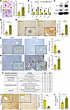 Hepatocyte-specific deletion of Smo induces hepatic iron accumulation and f