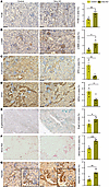 Hepatocyte-specific Smo deletion induces renal ferroptotic stress, senescen