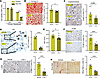Ferrostatin-1 treatment alleviates hepatic ferroptotic stress and attenuate