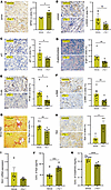 Ferrostatin-1 treatment mitigates renal ferroptotic stress, inflammation, f