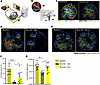 Ferrostatin-1 restores hepatic blood perfusion and reverses vascular dysfun