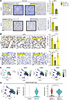 Ferrostatin-1 attenuates liver sinusoidal function and zonation in Smo-KO m