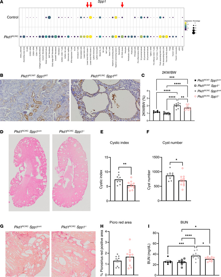 Loss of Spp1 improves PKD severity in the Pkd1RC/RC model.
(A) Dot plot ...