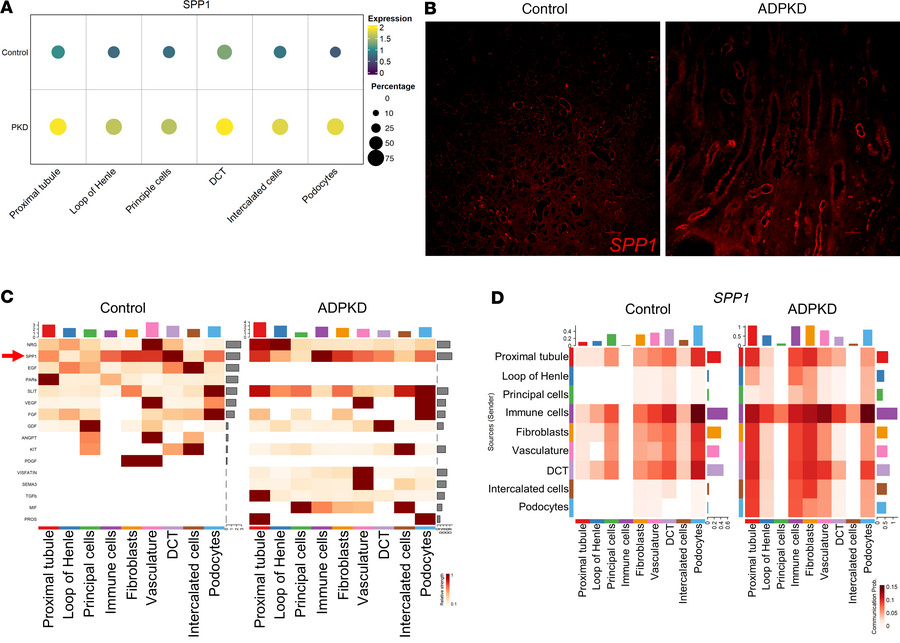 SPP1 expression and signaling are enriched in patients with ADPKD.
(A) D...