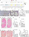 Loss of Spp1 improves PKD severity in the Pkd1RC/RC model.