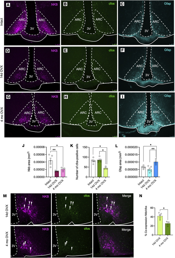 Differential NKB distribution, neuronal activity, and astrocyte reactivi...