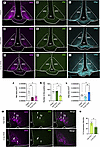 Differential NKB distribution, neuronal activity, and astrocyte reactivity