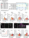 Comparative analysis of scRNA-seq Tagln2+ FAEC with FSFC profile of TAGLN+