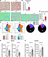 Expansion of TAGLN+ FAEC in a 12w Western diet model of MASLD.