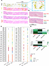 Spatial transcriptomics reveals TAGLN+ FAEC is a conserved feature of MASLD