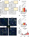 Induction of EndMT in response to CCl4-induced liver fibrosis and tissue re
