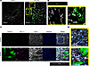 TAGLN+ and THY1.2+ expanded EC clusters display distinct localization and m