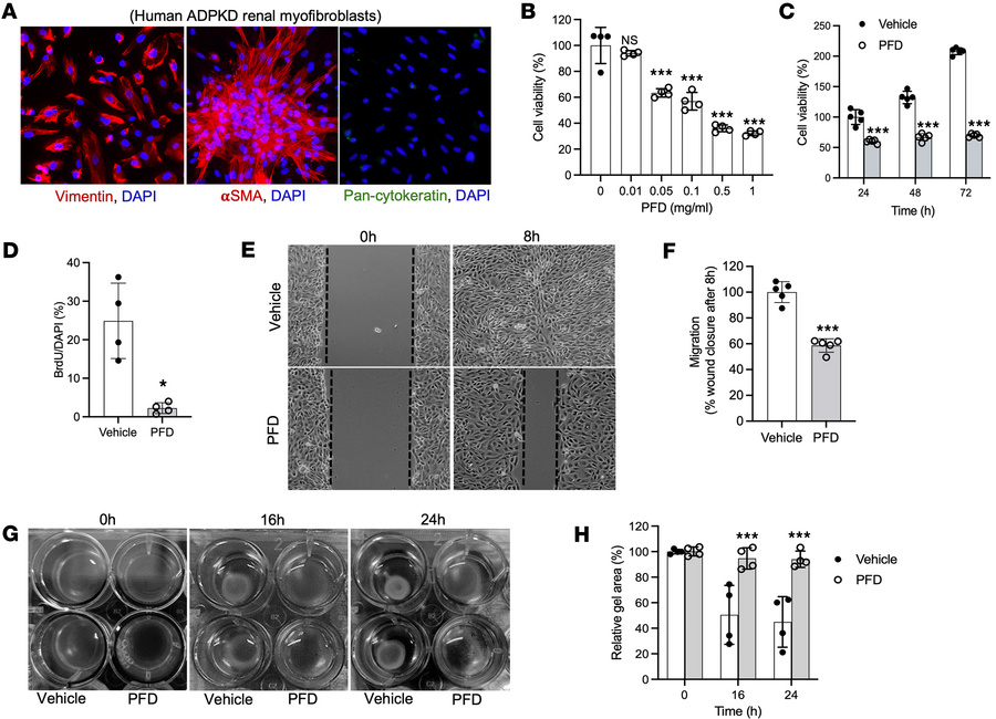 Effect of PFD on primary human ADPKD renal myofibroblasts.
(A) Human ADP...