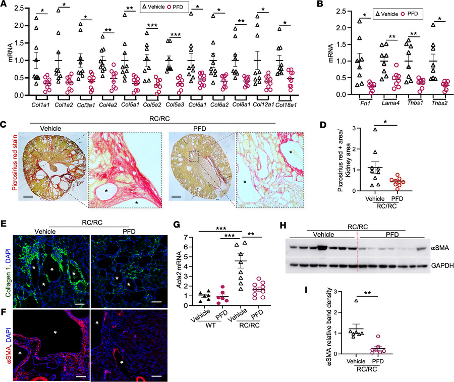 Effect of PFD on fibrosis in male RC/RC mouse kidneys.
(A) Kidney mRNA l...