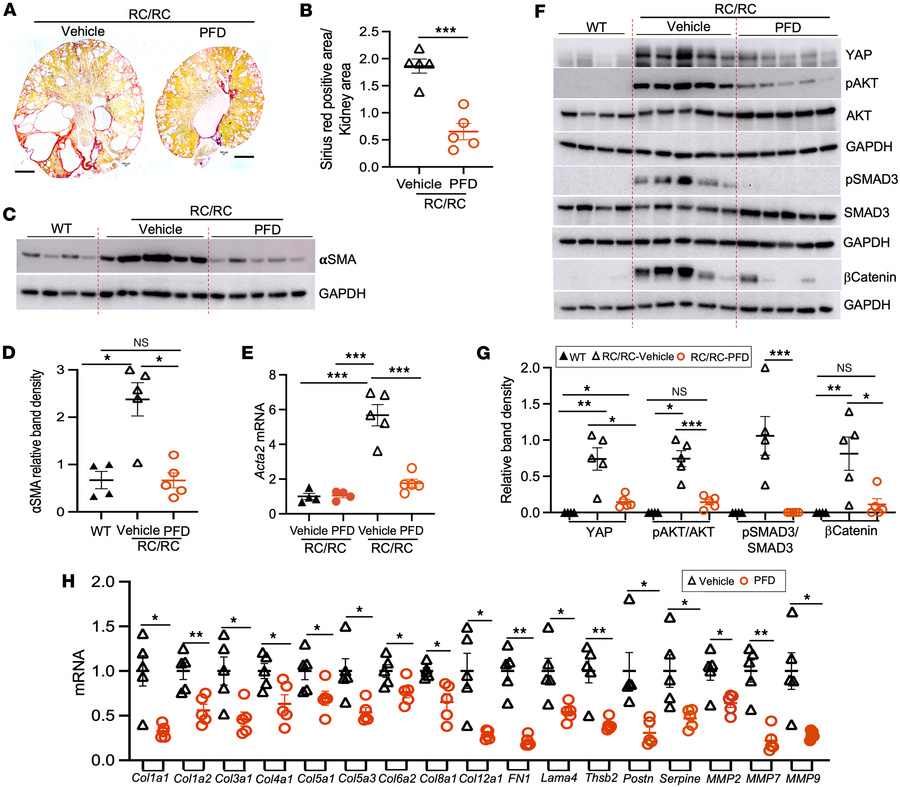 Effect of PFD on fibrosis in female RC/RC mouse kidneys.
(A) Sirius Red ...