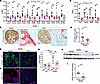 Effect of PFD on fibrosis in male RC/RC mouse kidneys.
